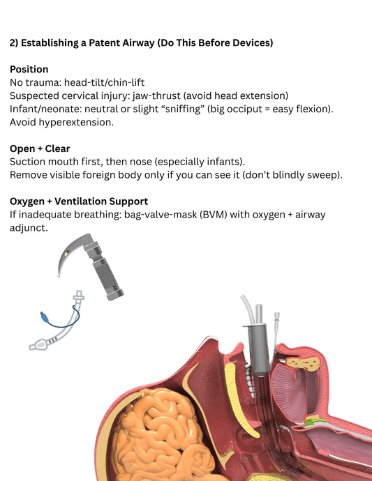 Airway Management Study Guide For RT Students | Adult, Peds & Neonatal - RRTNOW