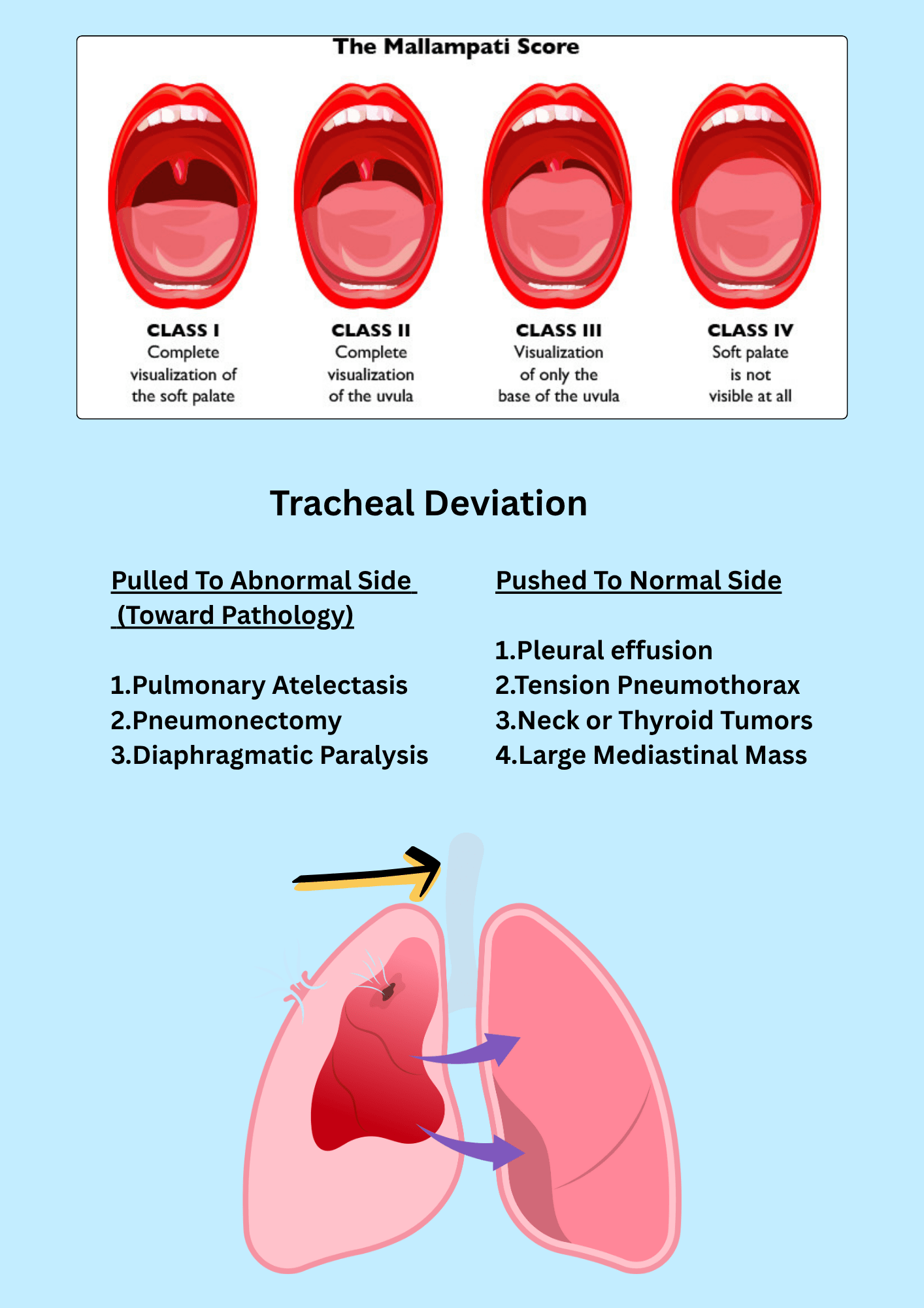 NBRC TMC Exam Study Guide + Free Review Guide | Respiratory Therapy Prep - RRTNOW