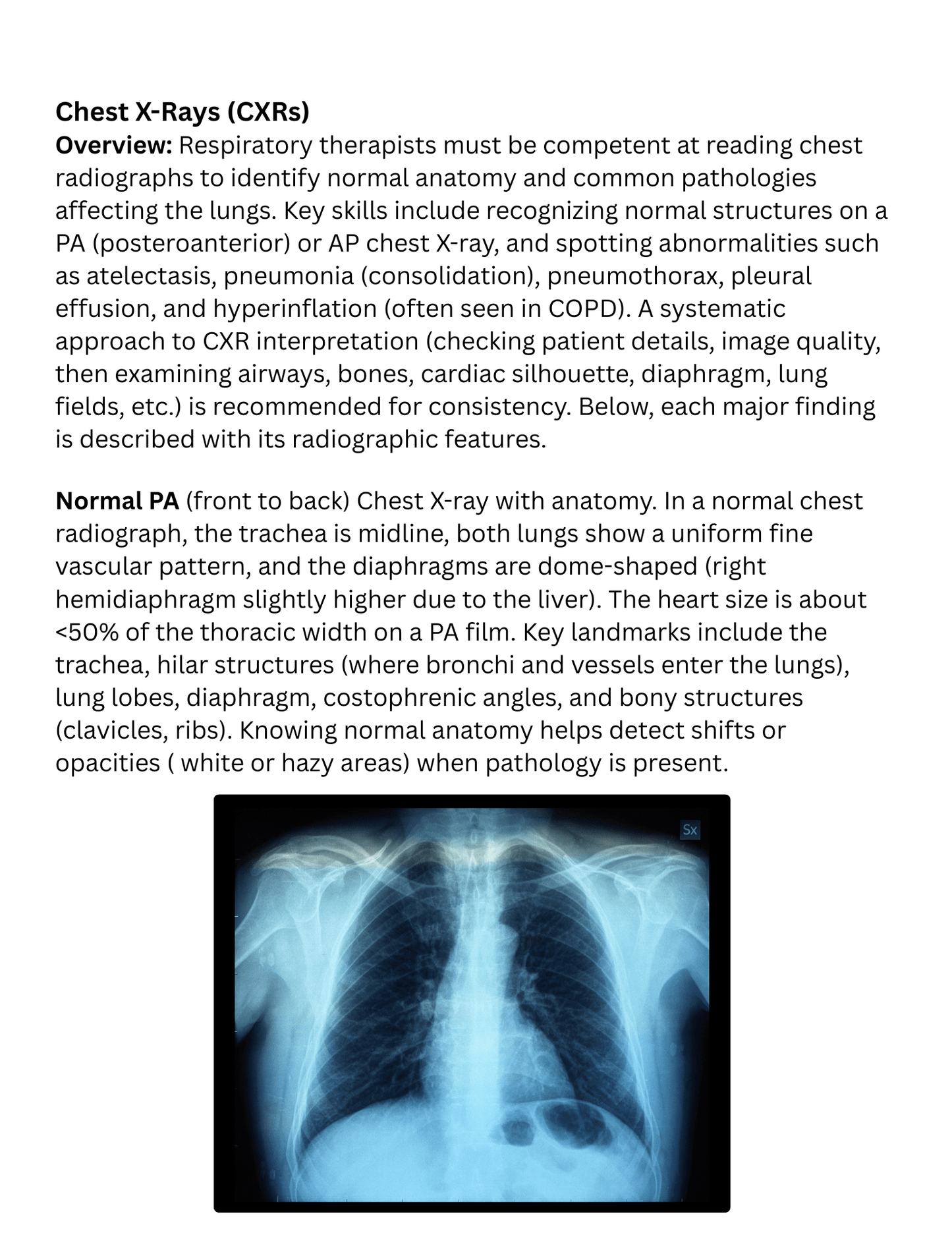 Chest X - Ray Interpretation Study Guide for Respiratory Therapy Students | RRTNOW - RRTNOW
