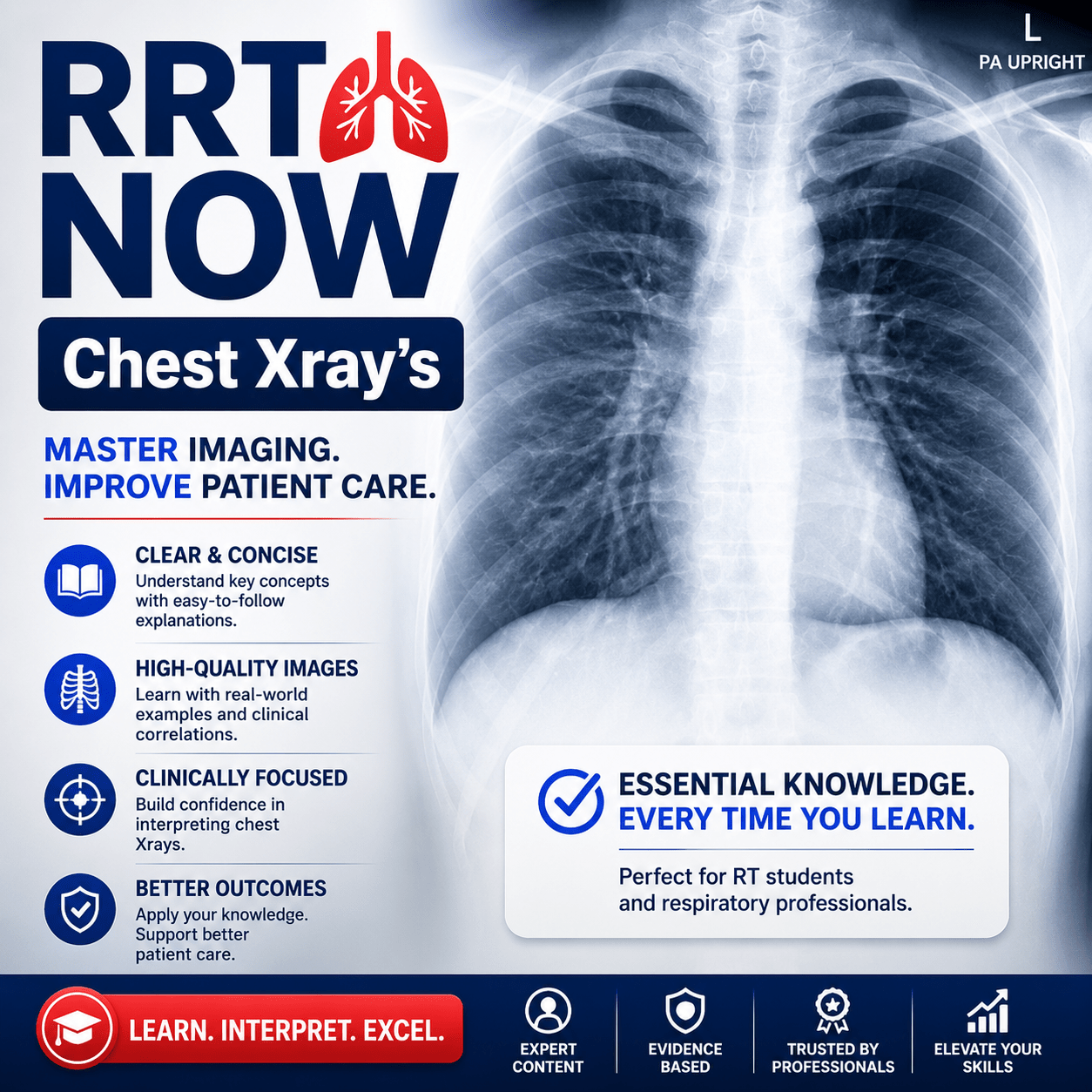Radiographic Chest Patterns - NBRC Exam Prep. Download & Print. Study with RRTNOW! - RRTNOW