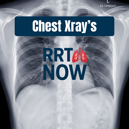 Chest X-Ray Interpretation Study Guide for Respiratory Therapy Students | RRTNOW